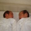 ハイリスクな双子妊娠。33週で緊急帝王切開に！【出産体験談】