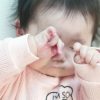 【ベビカム相談室】赤ちゃんの乳児湿疹…かゆみがある時の対処法は？